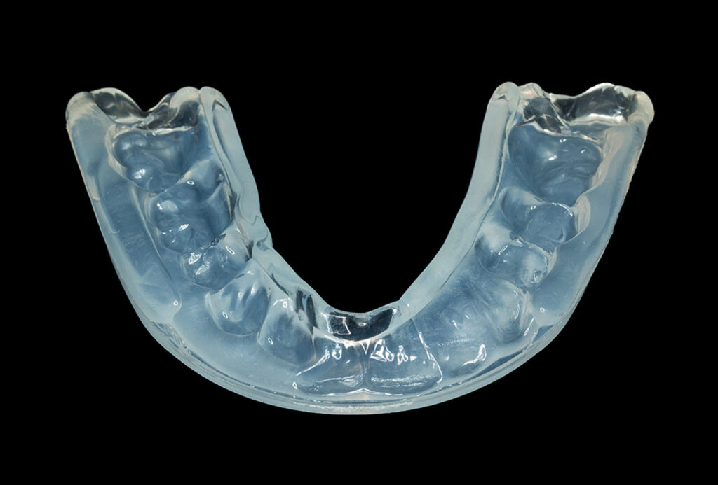 Plaqueocclusale2